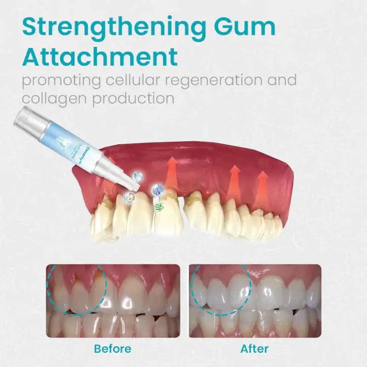 Fourovo CEOERTY™ GUM SHIELD THERAPY GEL