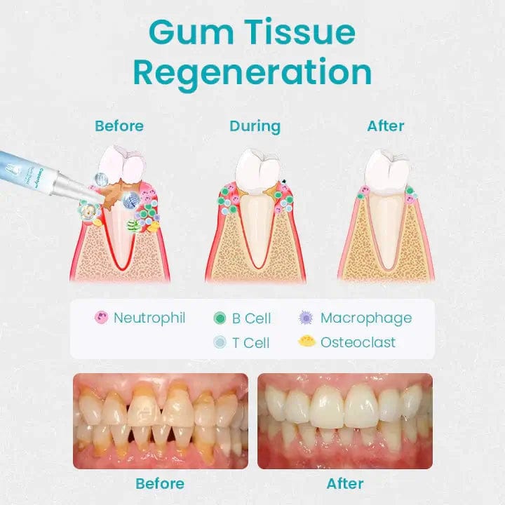 Fourovo CEOERTY™ GUM SHIELD THERAPY GEL