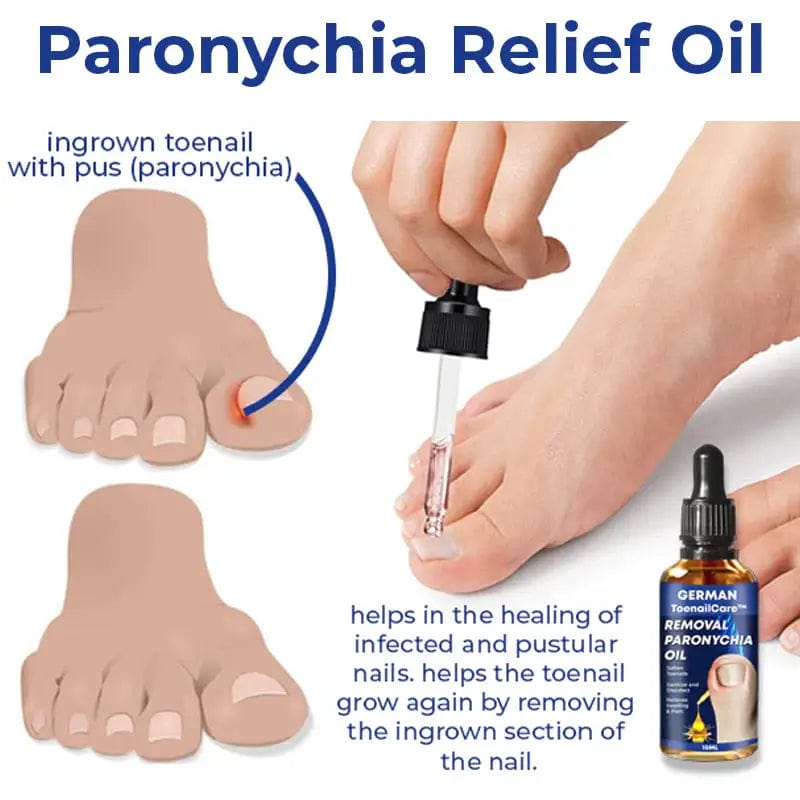 Fourovo German ToenailCare™ Removal Paronychia Oil