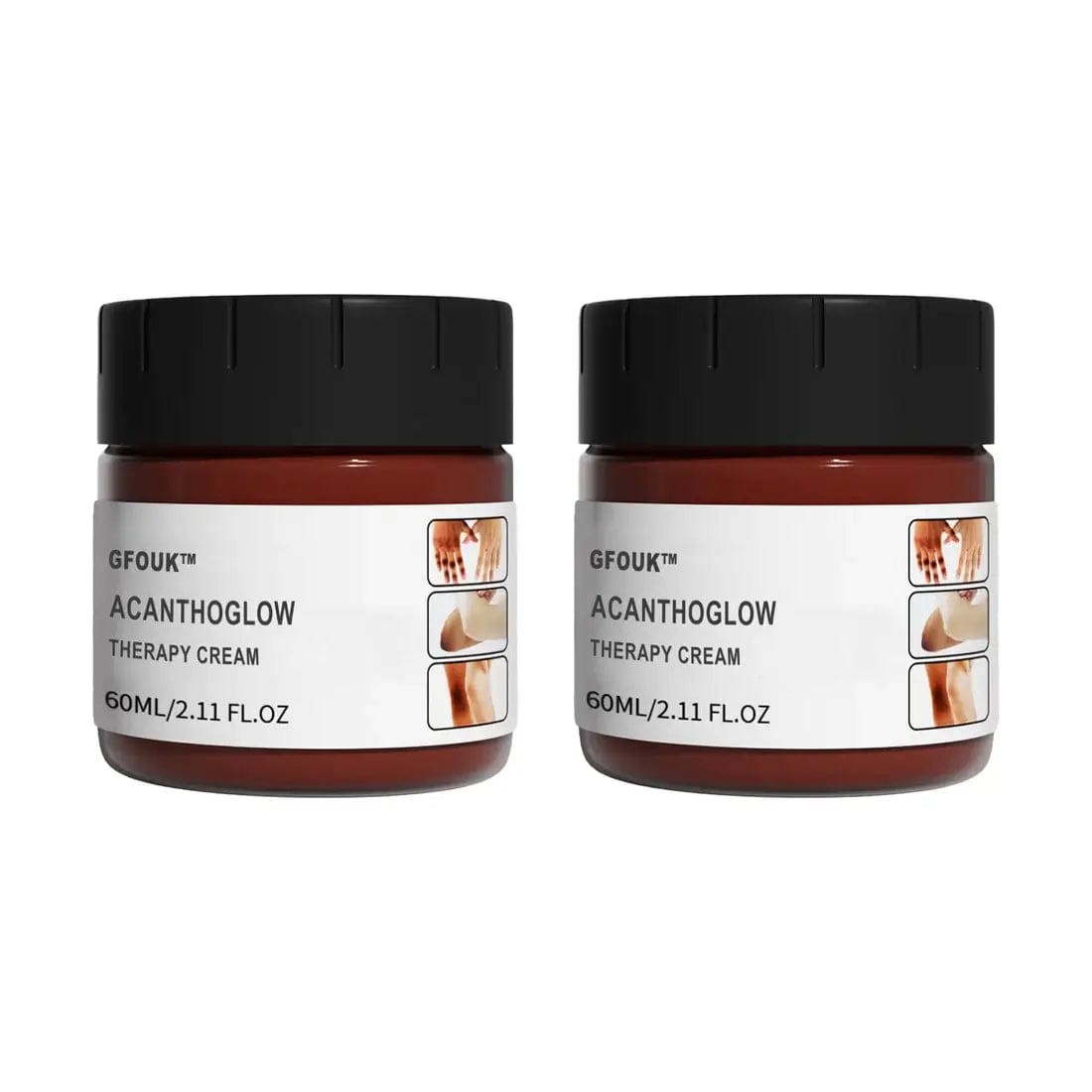 Fourovo GFOUK™ AcanthoGlow Therapy Cream 2PCS USD29.97 ❤️50% OFF❤️