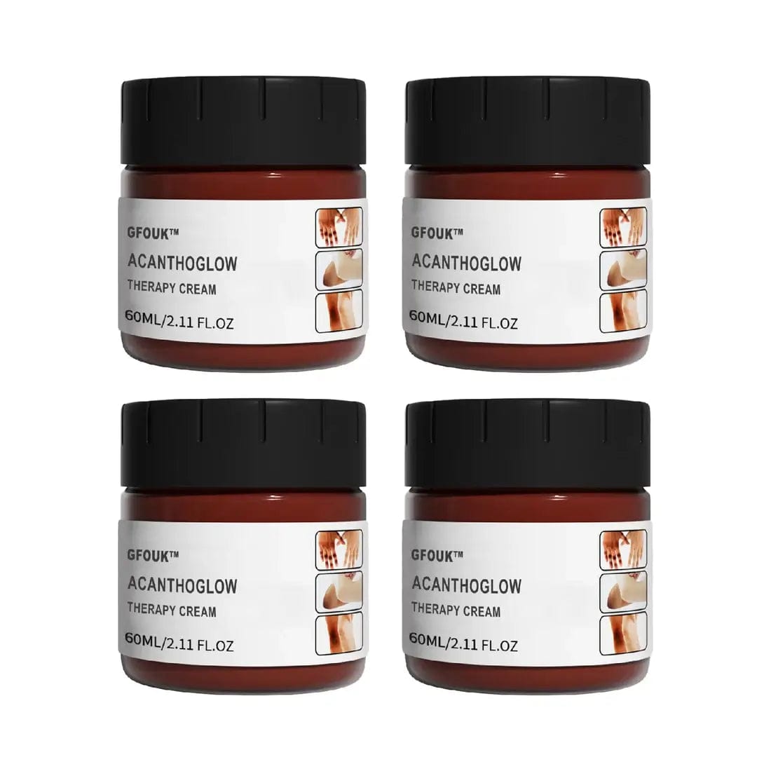 Fourovo GFOUK™ AcanthoGlow Therapy Cream 4PCS USD39.97 ❤️60% OFF❤️