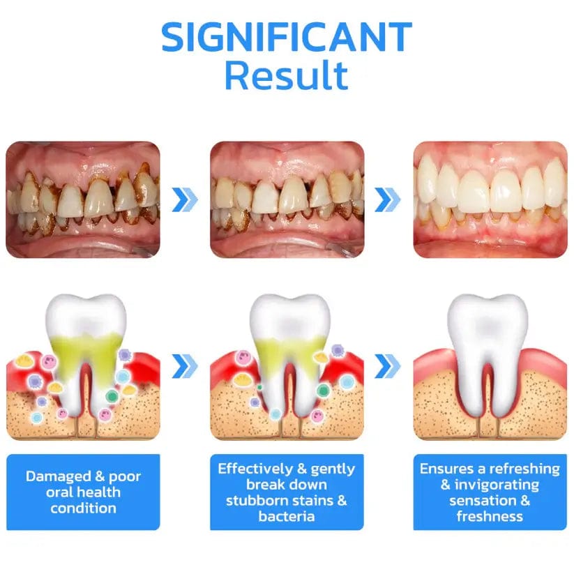 Fourovo GFOUK™ Gum Instant Treatment Gel