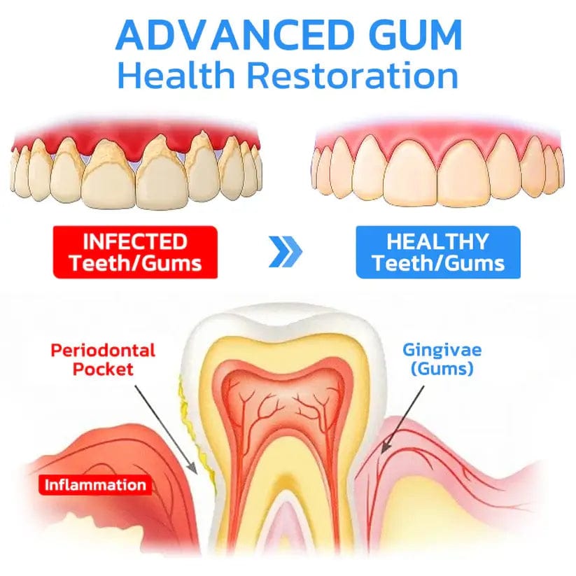 Fourovo GFOUK™ Gum Instant Treatment Gel