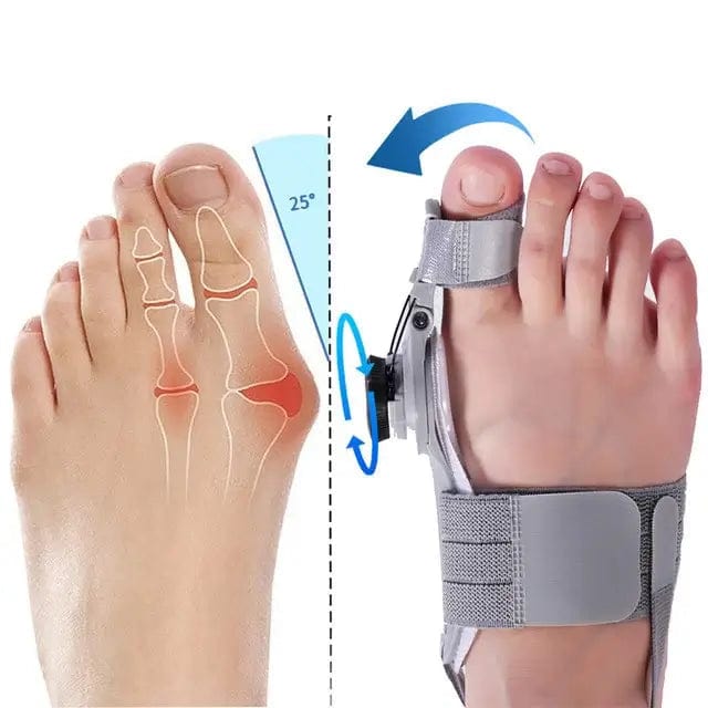 Fourovo Treatmedy Bunion Fix – Natural At-Home Bunion Relief