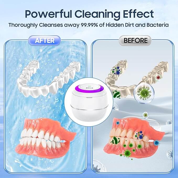 Fourovo Ultrasonic Dental Cleaning Machine